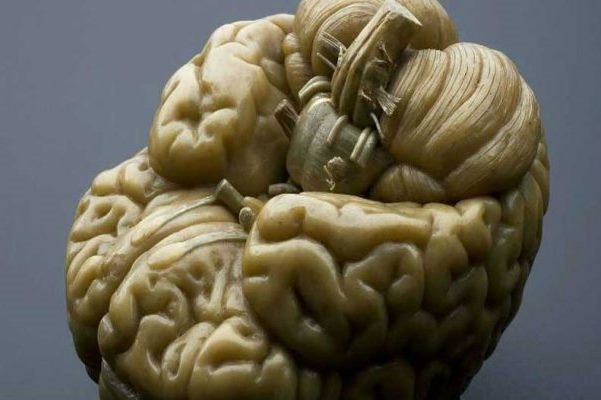 تولید سلول های سرطانی مغز در آزمایشگاه