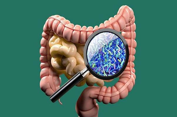 نقش باکتری های روده در شروع بیماری ام اس